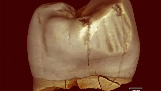 古代人の歯に見られる“つまようじ溝”は道具使用の証拠ではない可能性が研究で判明。霊長類でも自然発生することが確認され、古代人の生活像が再評価されつつある最新知見を解説します。